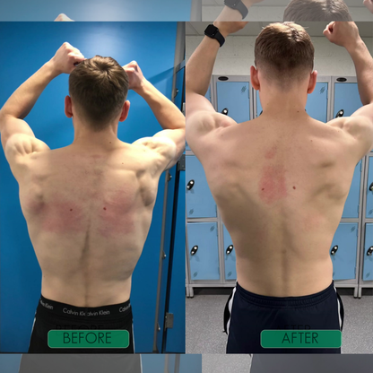 Instant Posture Correctorr